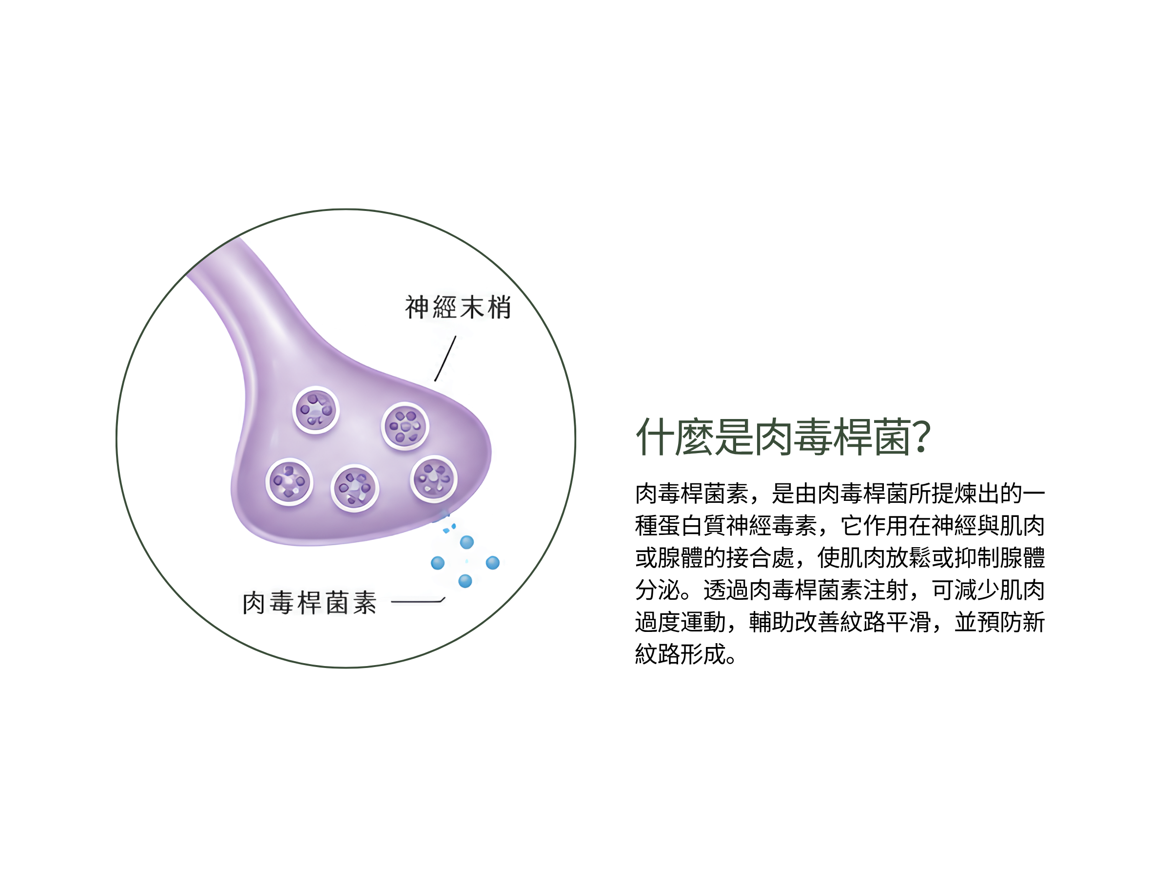 什麼是肉毒桿菌素？  醫美診所療程中，效果顯著、幾乎無恢復期，最受歡迎的應該非肉毒桿菌莫屬了。肉毒桿菌素由美國的眼科醫生發現，最早是運用在眼睛斜視的治療上，後來發現肉毒桿菌素能讓造成皺紋的肌肉放鬆，消除皺紋；也能改善過度發達的肌肉，修飾臉型及腿型，因此大量運用在美容的治療上。  肉毒桿菌素，是由肉毒桿菌所提煉出的一種蛋白質神經毒素，它作用在神經與肌肉或腺體的接合處，使肌肉放鬆或抑制腺體分泌。透過肉毒桿菌素注射，可減少肌肉過度運動，輔助改善紋路平滑，並預防新紋路形成。